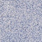 Anti-PRRT2 Antibody