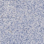 Immunohistochemical staining of human pancreas shows no positivity as expected.