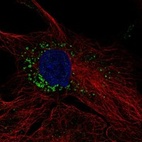 Anti-TMEM263 Antibody