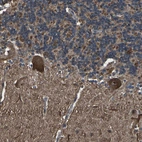 Immunohistochemical staining of human cerebellum shows moderate to strong cytoplasmic positivity in Purkinje cells.