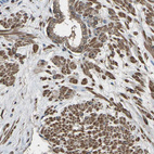 Immunohistochemical staining of human prostate shows moderate to strong cytoplasmic positivity in smooth muscle cells.