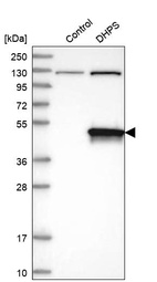 Western blot analysis in control (vector only transfected HEK293T lysate) and DHPS over-expression lysate (Co-expressed with a C-terminal myc-DDK tag (~3.1 kDa) in mammalian HEK293T cells, LY400714).