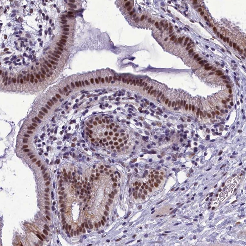 Anti-CEACAM19 Antibody