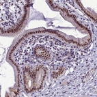 Anti-CEACAM19 Antibody