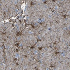 Anti-KLHDC8B Antibody