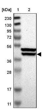Lane 1: Marker [kDa] 230, 130, 95, 72, 56, 36, 28, 17, 11_br/_Lane 2: Human cell line RT-4