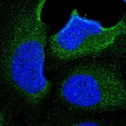 Immunofluorescent staining of human cell line U-2 OS shows localization to cytosol.