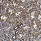 Immunohistochemical staining of human kidney shows strong cytoplasmic positivity in cells in tubules.