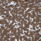 Immunohistochemical staining of human liver shows strong cytoplasmic positivity in hepatocytes.