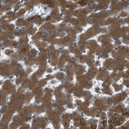 Immunohistochemical staining of human liver shows strong cytoplasmic positivity in hepatocytes.