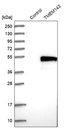 Anti-TMEM143 Antibody