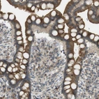 Immunohistochemical staining of human colon shows moderate cytoplasmic and membranous positivity in glandular cells.