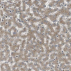 Immunohistochemical staining of human liver shows moderate cytoplasmic positivity in hepatocytes.