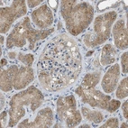 Immunohistochemical staining of human kidney shows moderate cytoplasmic positivity in cells in tubules.