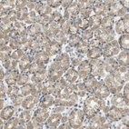 Anti-ZDHHC20 Antibody