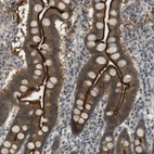 Anti-ZDHHC20 Antibody