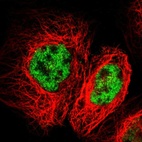 Immunofluorescent staining of human cell line A-431 shows localization to nucleoplasm.