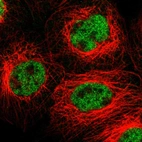 Immunofluorescent staining of human cell line A-431 shows localization to nucleoplasm.