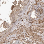 Immunohistochemical staining of human prostate shows strong membranous positivity in glandular cells.