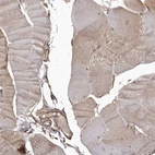 Immunohistochemical staining of human skeletal muscle shows negative positivity in myocytes as expected.