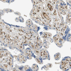 Immunohistochemical staining of human placenta shows moderate cytoplasmic positivity in endothelial cells.