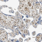 Immunohistochemical staining of human placenta shows moderate cytoplasmic positivity in endothelial cells.