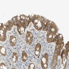 Immunohistochemical staining of human rectum shows moderate cytoplasmic positivity in glandular cells.