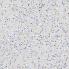Immunohistochemical staining of human liver shows no positivity in hepatocytes as expected.