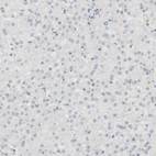 Immunohistochemical staining of human liver shows no positivity in hepatocytes as expected.