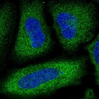 Anti-PDE3A Antibody