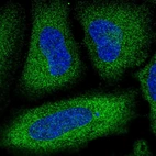 Immunofluorescent staining of human cell line HeLa shows localization to cytosol.