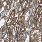 Anti-RNF130 Antibody
