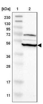 Lane 1: Marker [kDa] 230, 130, 95, 72, 56, 36, 28, 17, 11_br/_Lane 2: Human cell line RT-4