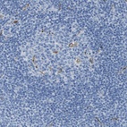 Anti-CD320 Antibody