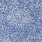 Anti-CD320 Antibody