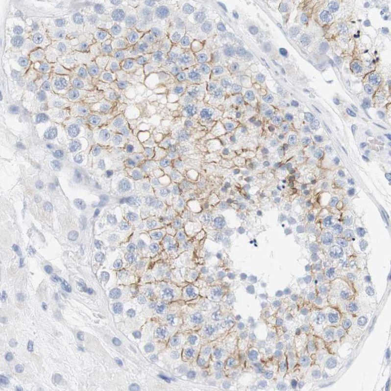 Anti-OPRM1 Antibody