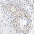 Anti-OPRM1 Antibody