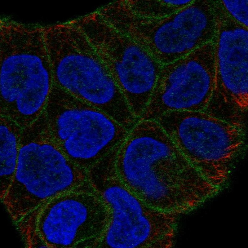 Anti-SLITRK6 Antibody