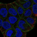 Anti-SLITRK6 Antibody