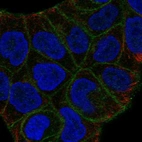 Anti-SLITRK6 Antibody
