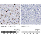 Anti-P2RY12 Antibody