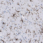 Anti-P2RY12 Antibody