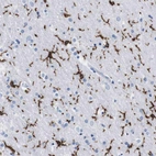 Immunohistochemical staining of human cerebral cortex shows strong cytoplasmic positivity in microglia.