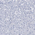 Immunohistochemical staining of human liver shows no positivity as expected.