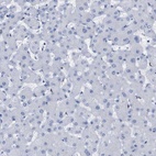 Anti-P2RY12 Antibody