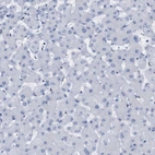 Immunohistochemical staining of human liver shows no positivity as expected.