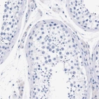 Immunohistochemical staining of human testis shows no positivity in cells in seminiferous ducts as expected.