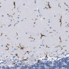 Anti-P2RY12 Antibody