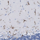Immunohistochemical staining of human cerebellum shows strong cytoplasmic positivity in microglia.