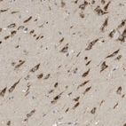 Anti-C19orf18 Antibody
